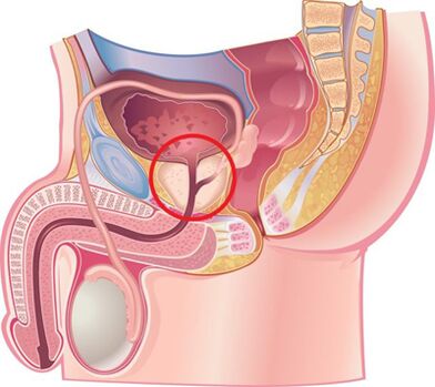 Расположение простаты у мужчин.